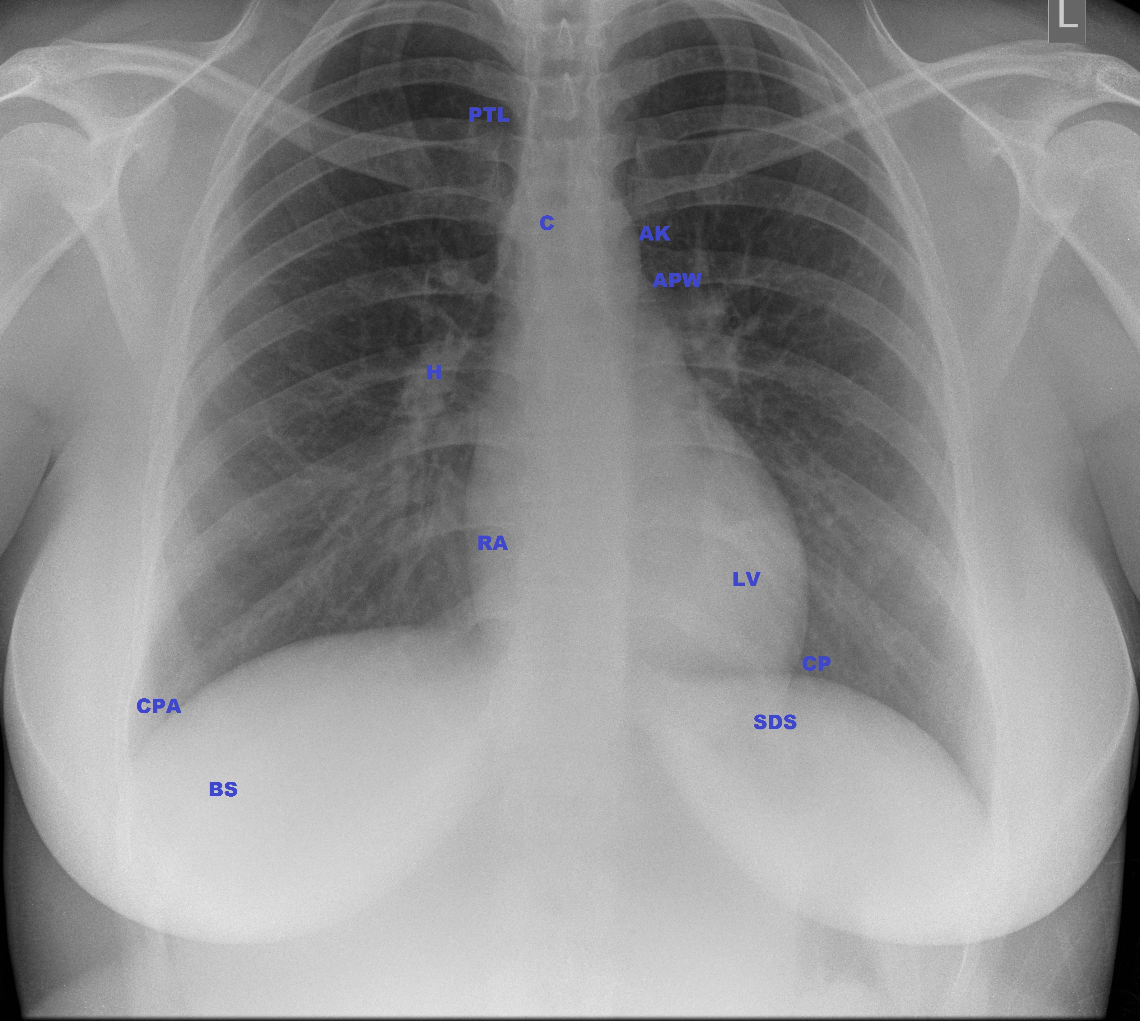 Image Radiopaedia Org