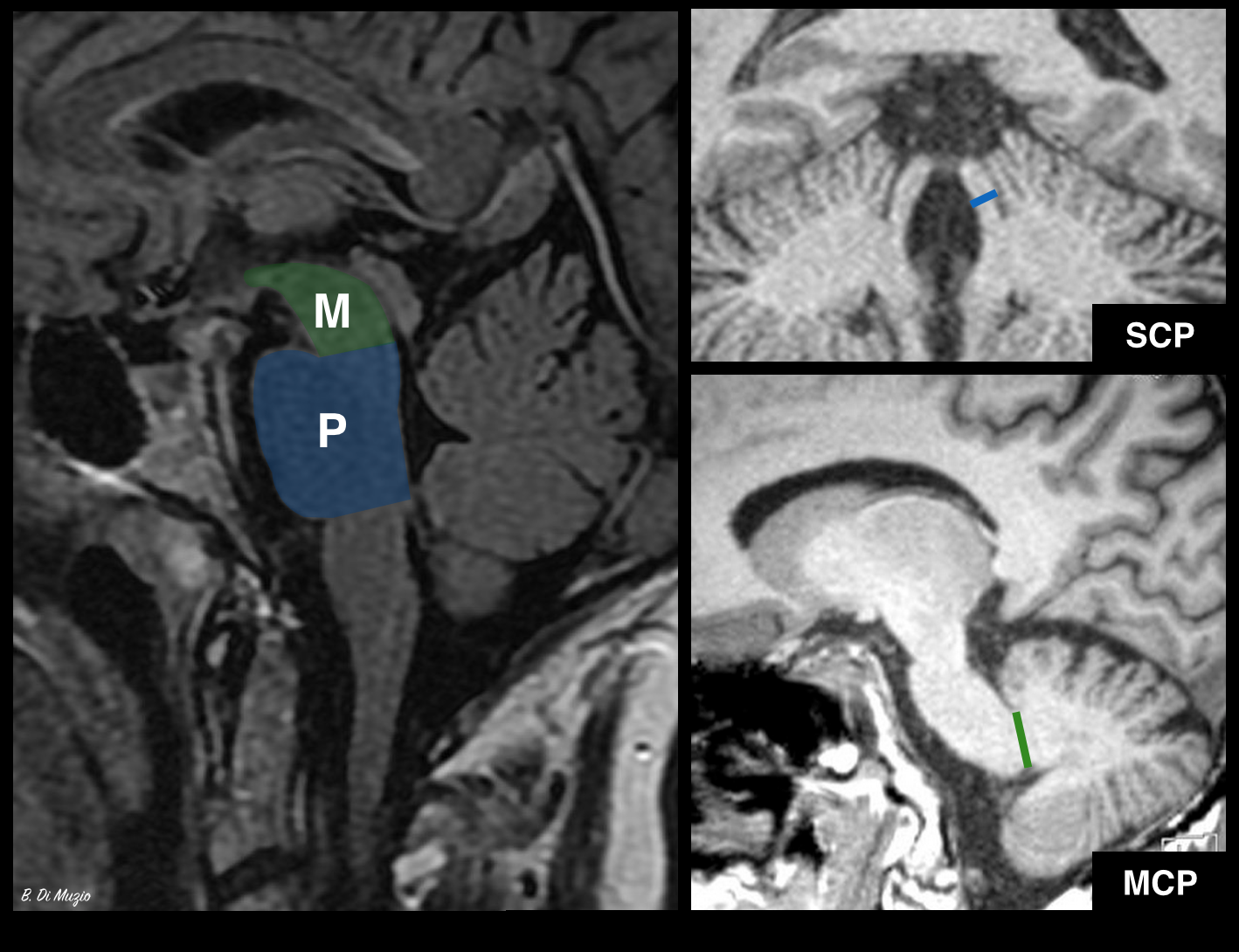 Image Radiopaedia Org