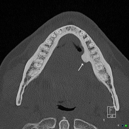 Image Radiopaedia Org