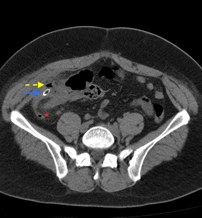 Image Radiopaedia Org