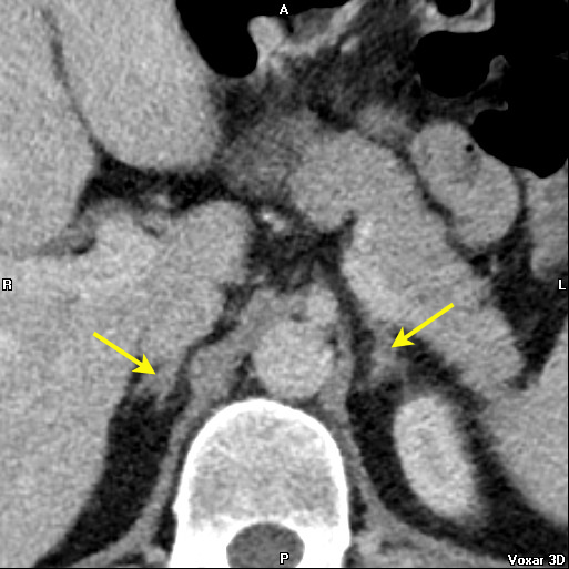 Image Radiopaedia Org