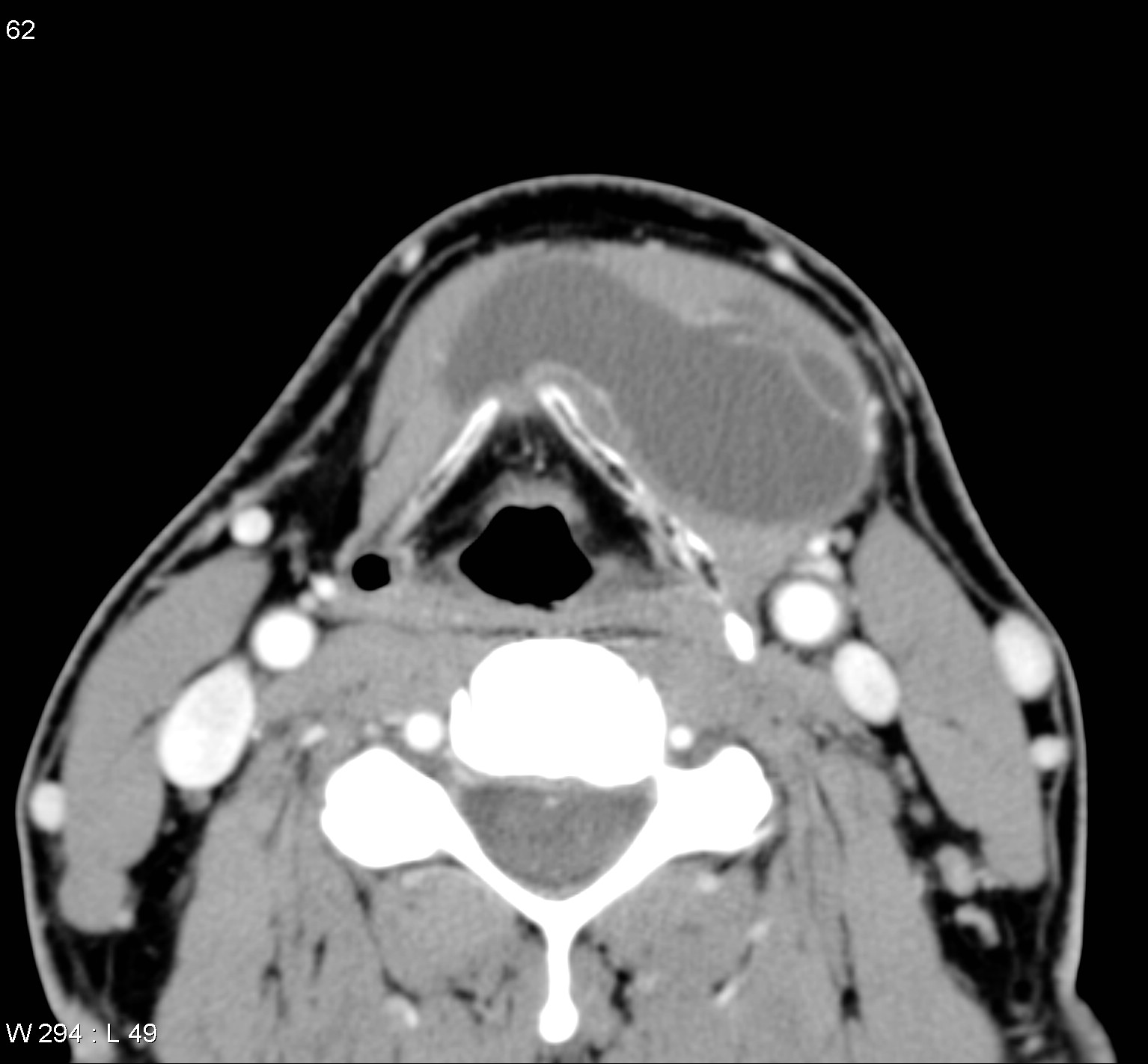 Image Radiopaedia Org