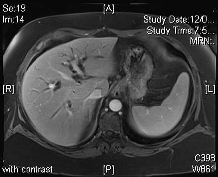 Image Radiopaedia Org