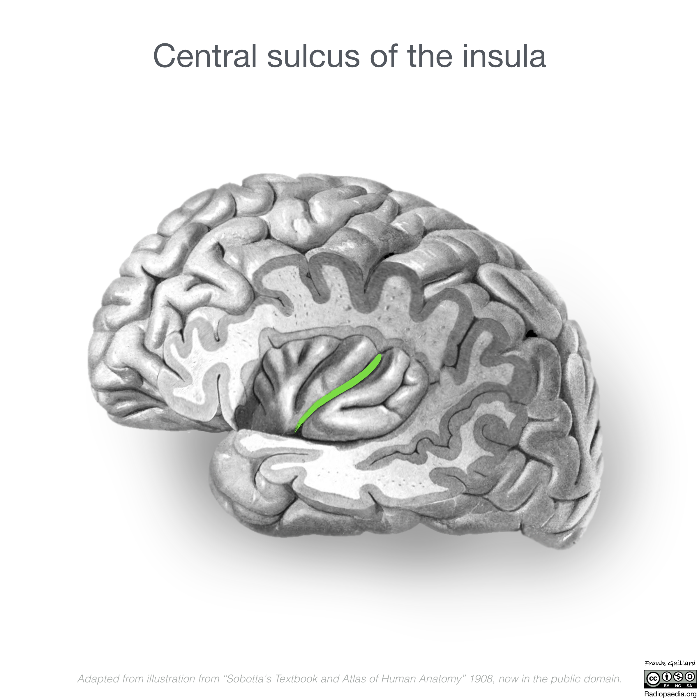 Neuroanatomy Insular Cortex Diagrams Image Radiopaedia Org