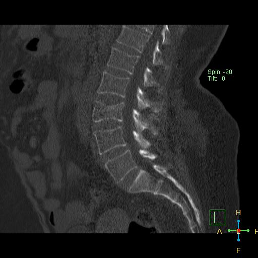 Image Radiopaedia Org