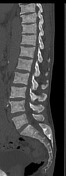 Viewing Playlist Abdomen Radiopaedia Org