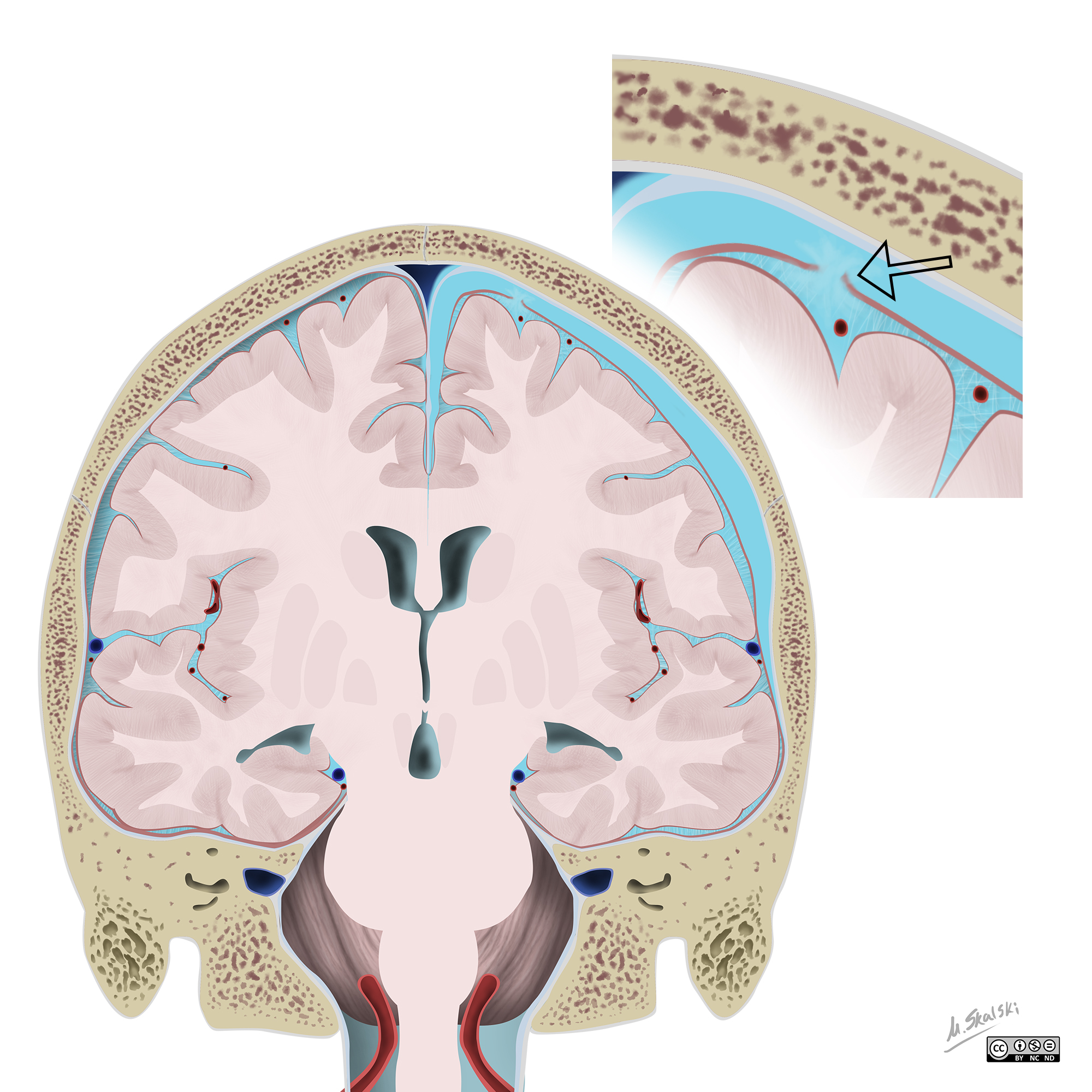 Image Radiopaedia Org