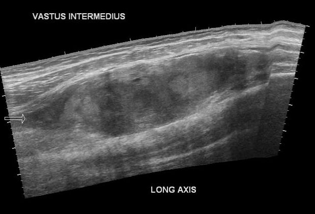 Image Radiopaedia Org