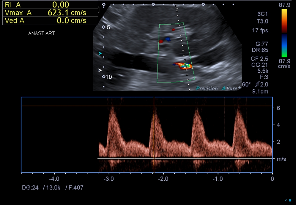 Image Radiopaedia Org