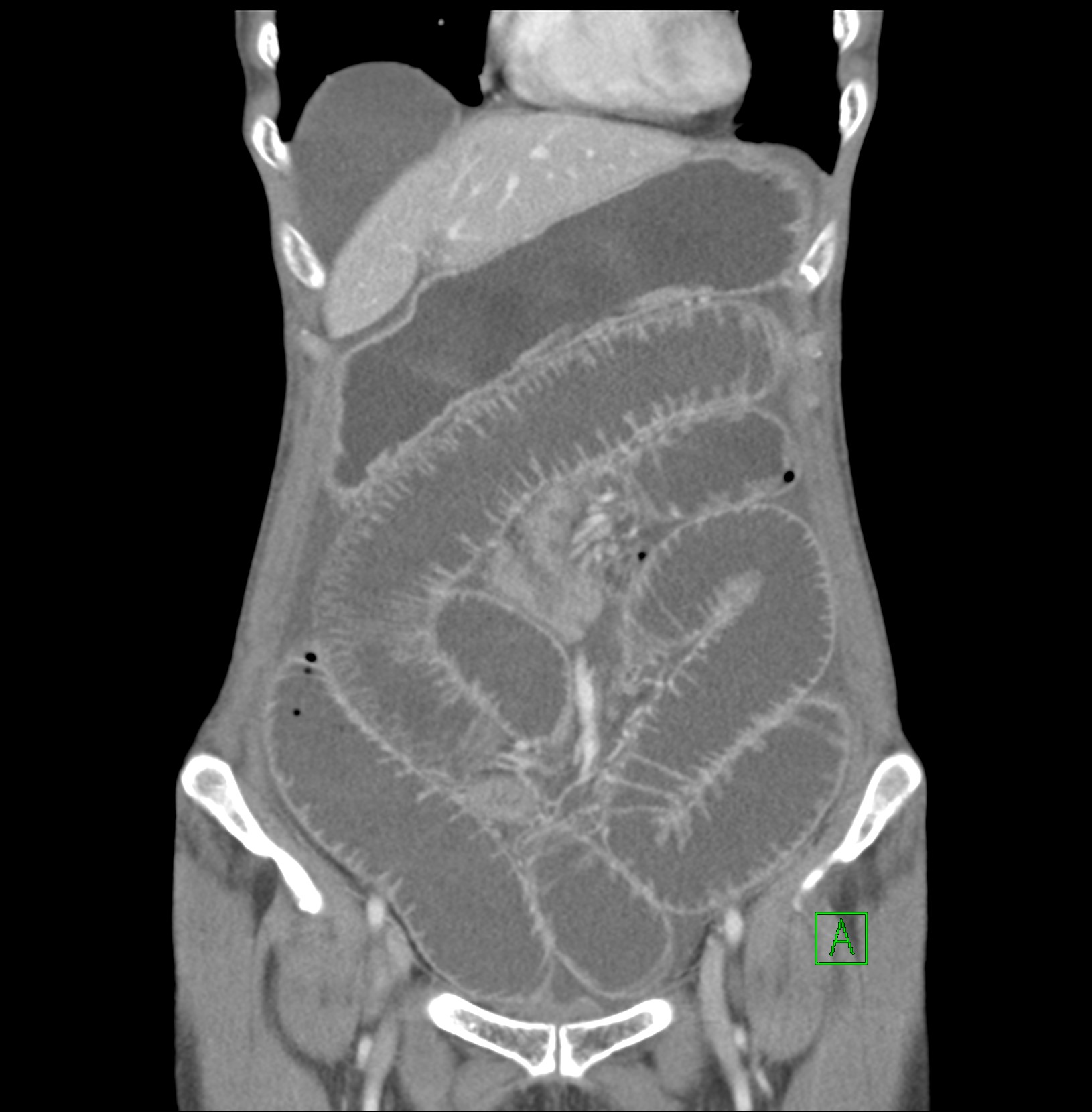 Image Radiopaedia Org