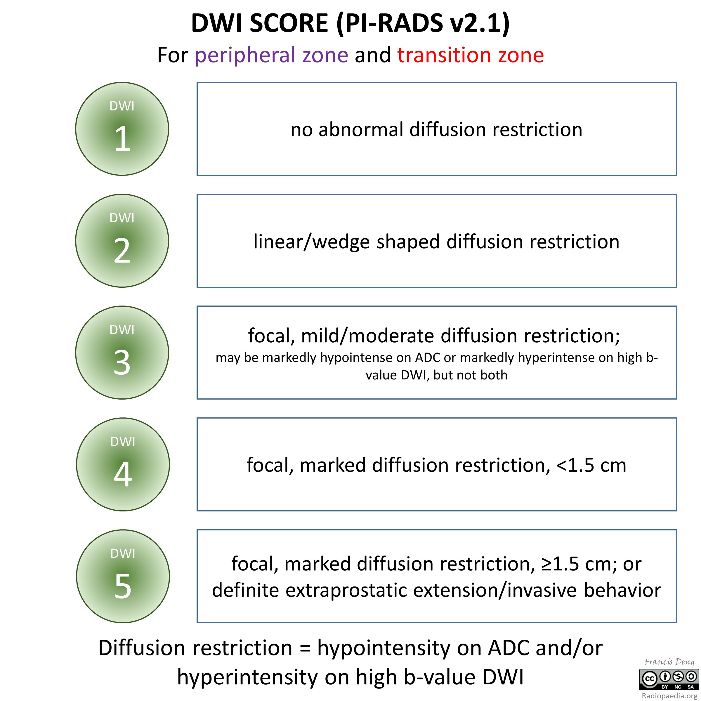 Pi Rads Radiopaedia Hot Sex Picture