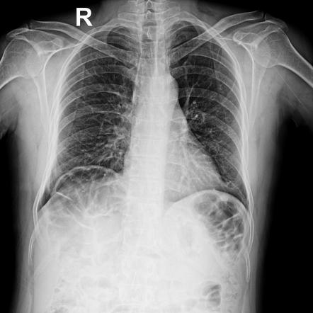 Playlist How To Read An Abdominal Ct Chapter Supplement By Md