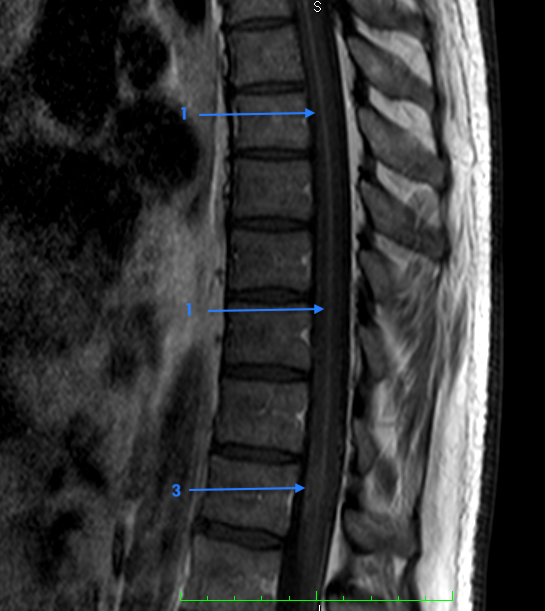 Image Radiopaedia Org