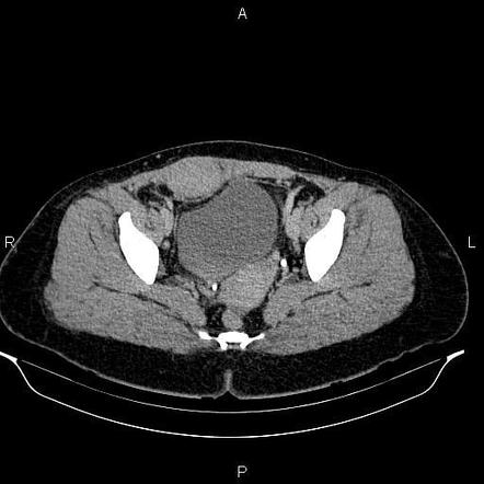 Radiology Quiz Radiopaedia Org