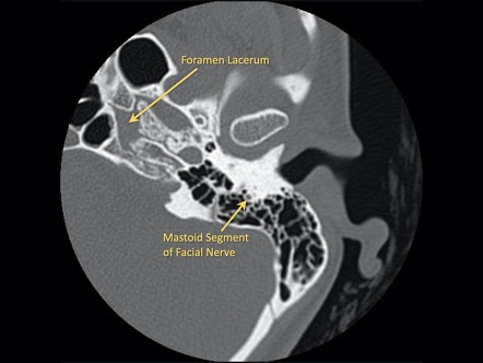 Viewing Playlist 2b Neck Radiopaedia Org