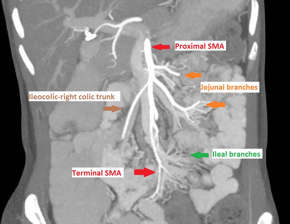 Image Radiopaedia Org