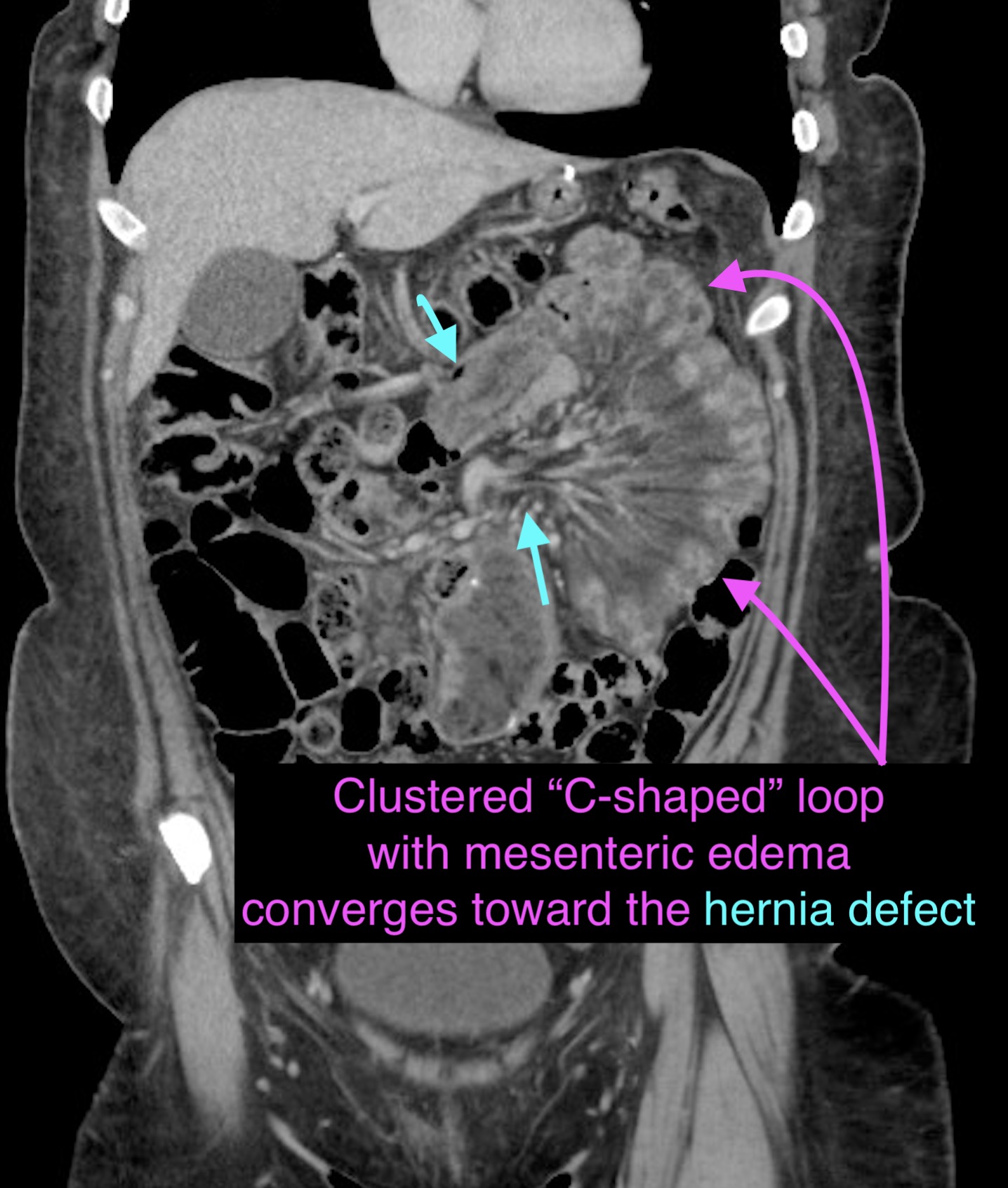 Image Radiopaedia Org