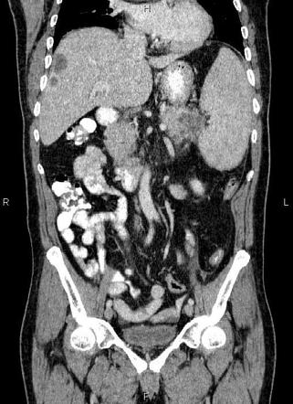 Radiology Quiz 85051 Radiopaedia Org