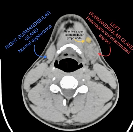 Image Radiopaedia Org