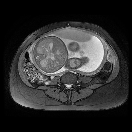 Viewing Playlist Abdomen Radiopaedia Org