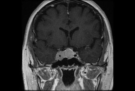 Viewing Playlist Top Diff Head And Neck Radiopaedia Org