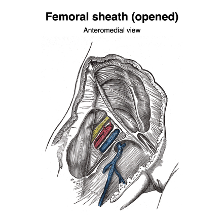 Femoral Sheath Radiology Reference Article Radiopaedia Org