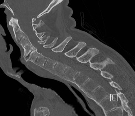 Orthopaedics RIPAS Playlist Radiopaedia Org