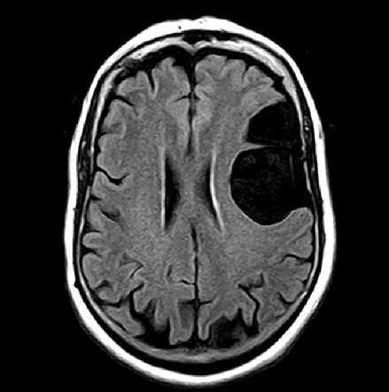 Radiology Quiz 94256 Radiopaedia Org