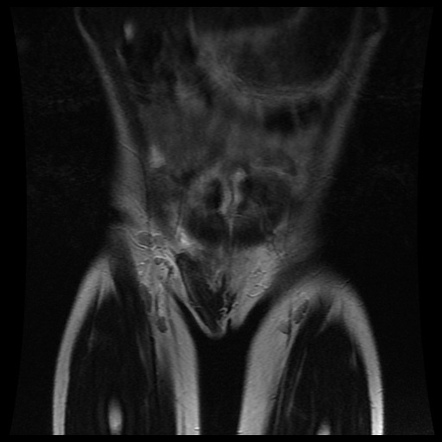 Radiology Quiz 94700 Radiopaedia Org