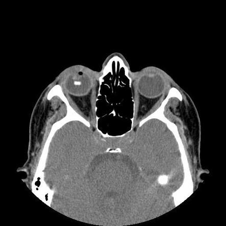 Radiology Quiz Radiopaedia Org