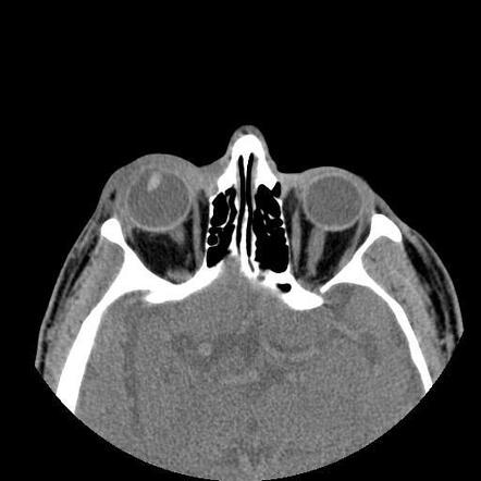 Radiology Quiz 98232 Radiopaedia Org