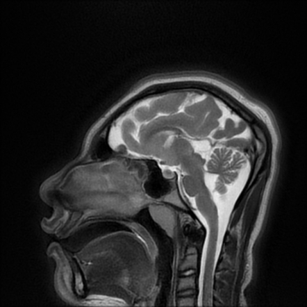 Viewing Playlist Brain Radiopaedia Org