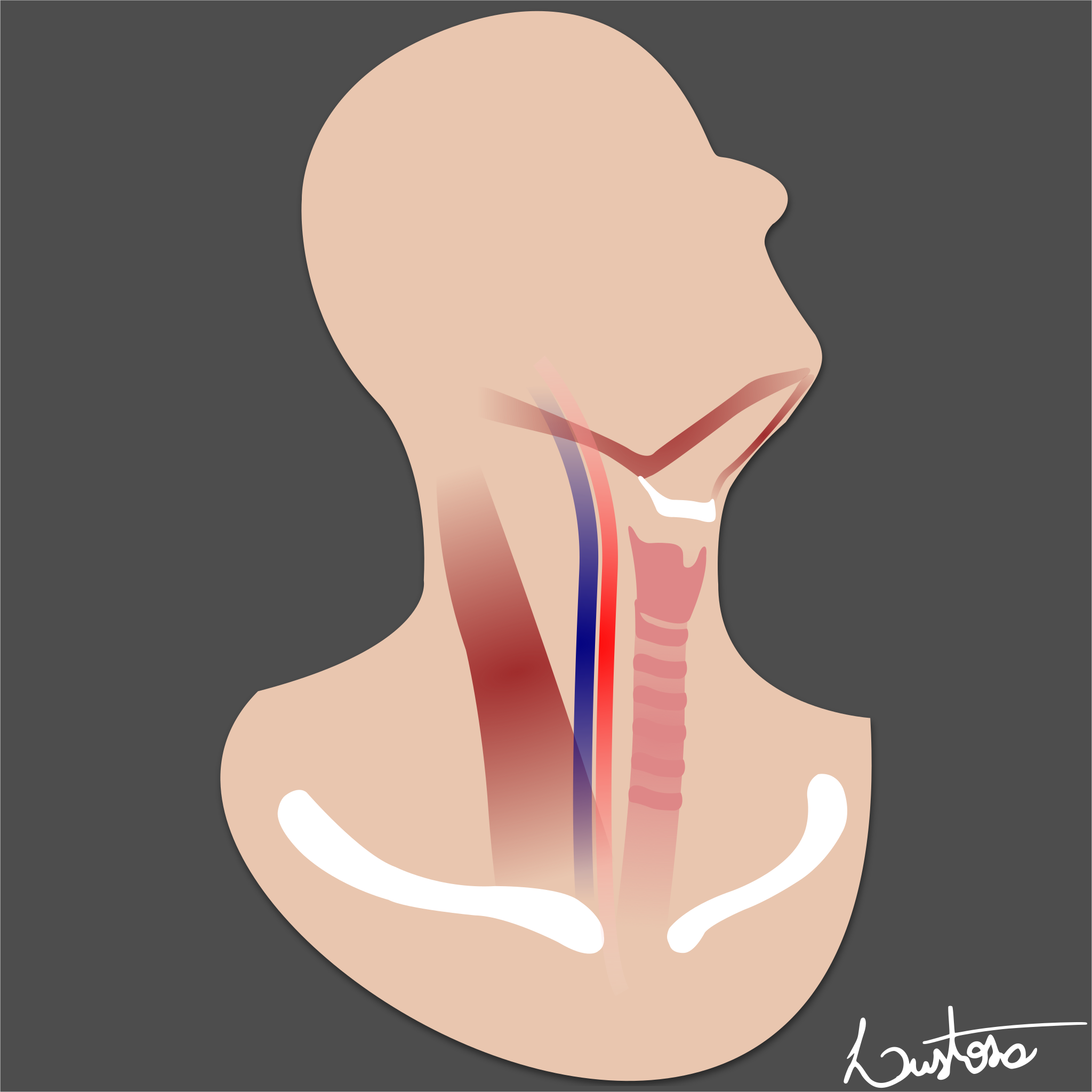 Lymph Node Levels Of The Neck Image Radiopaedia Org