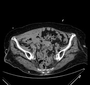 Viewing Playlist Abdomen Radiopaedia Org