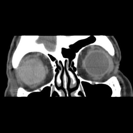 Radiology Quiz Radiopaedia Org