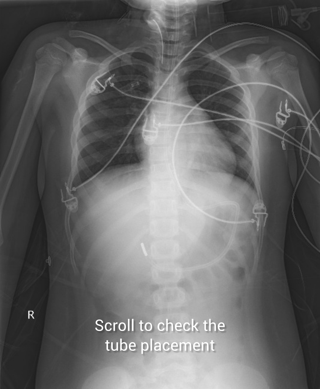 Image Radiopaedia Org