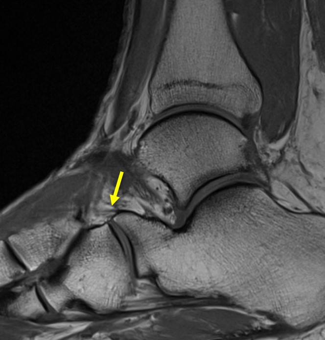 Image Radiopaedia Org