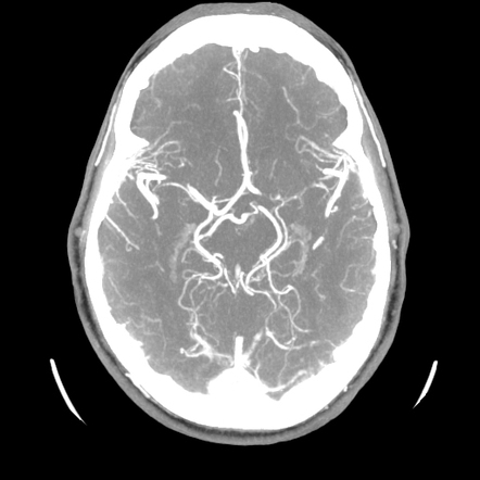 Radiology Quiz Radiopaedia Org