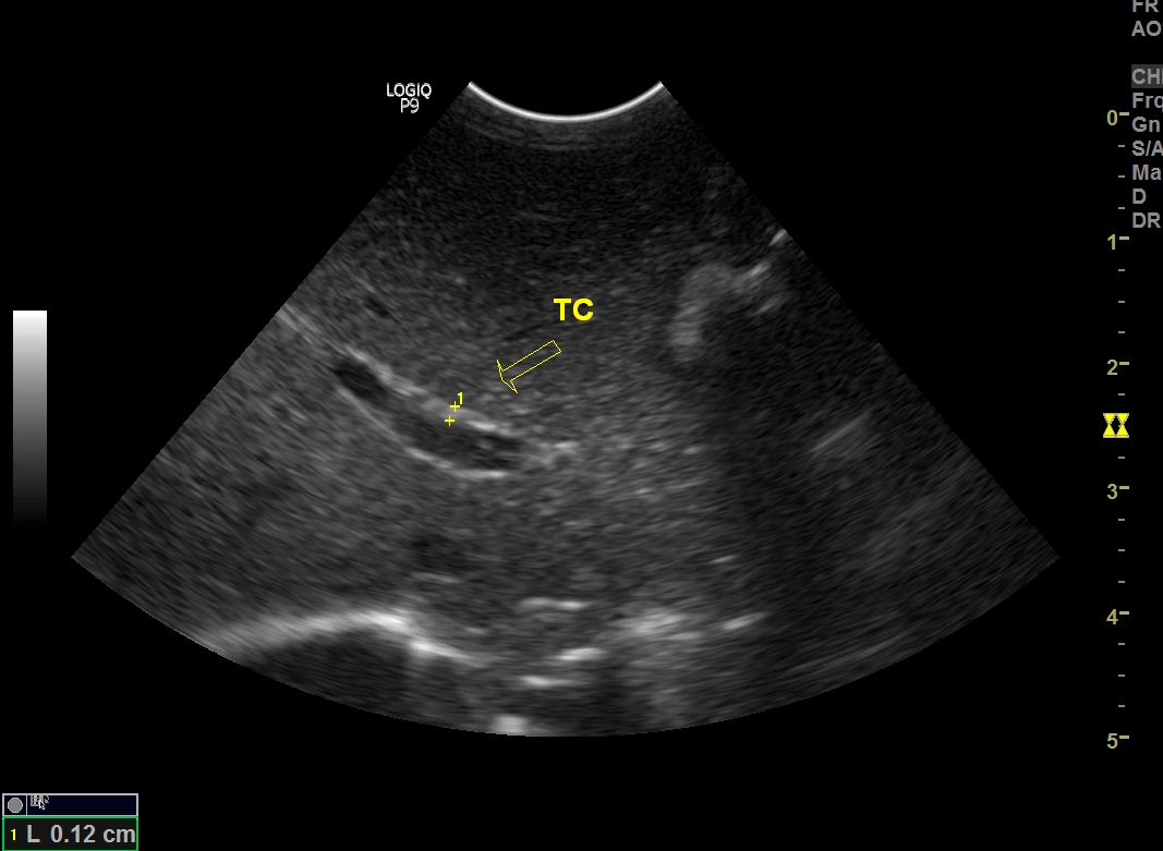 Image Radiopaedia Org