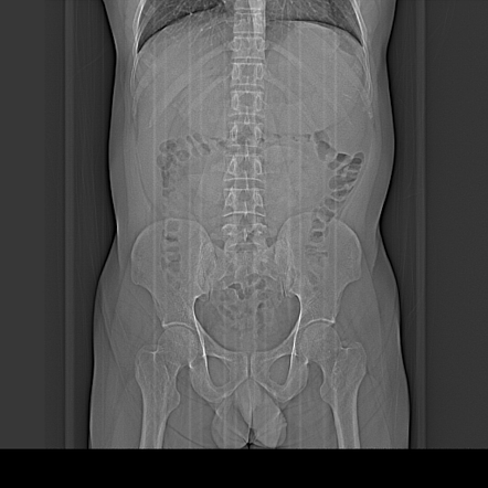 Viewing Playlist Abdomen Pelvis Radiopaedia Org