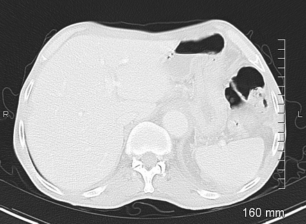 Images Radiopaedia Org