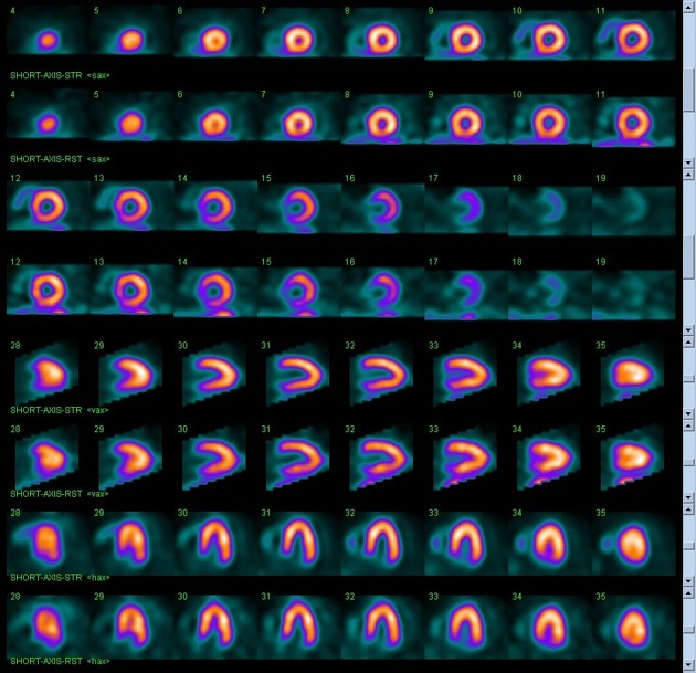 Images Radiopaedia Org