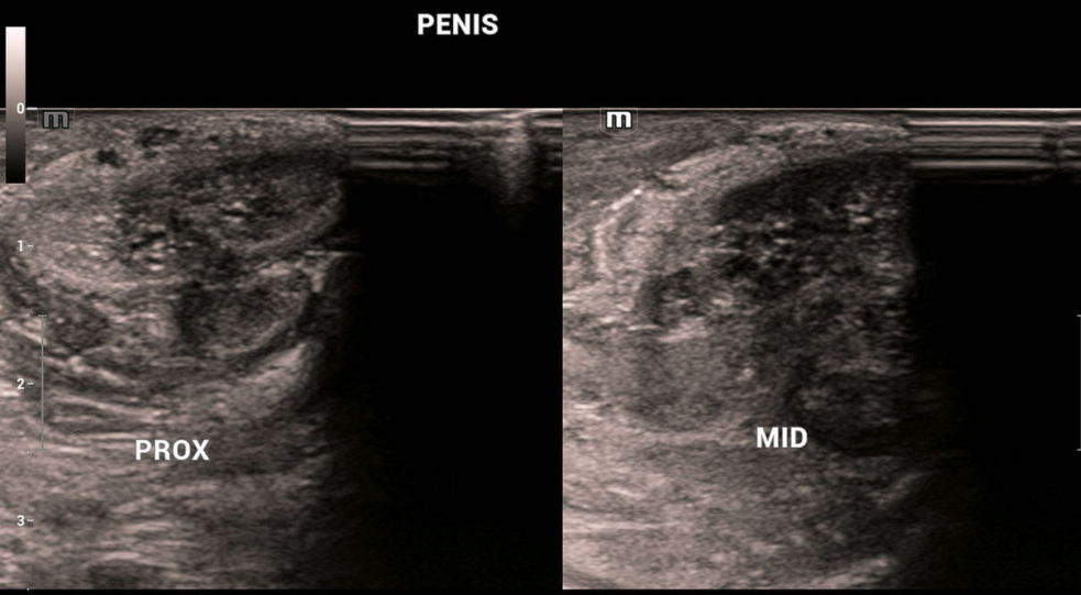 Image Radiopaedia Org