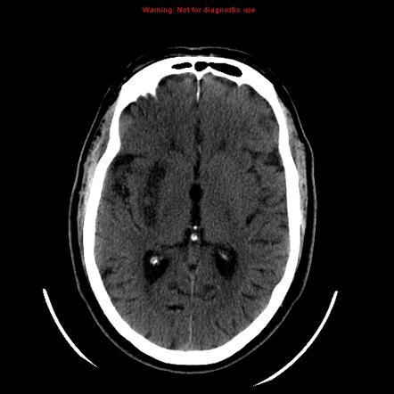 Viewing Playlist Ct Angio Semin Rs Radiopaedia Org