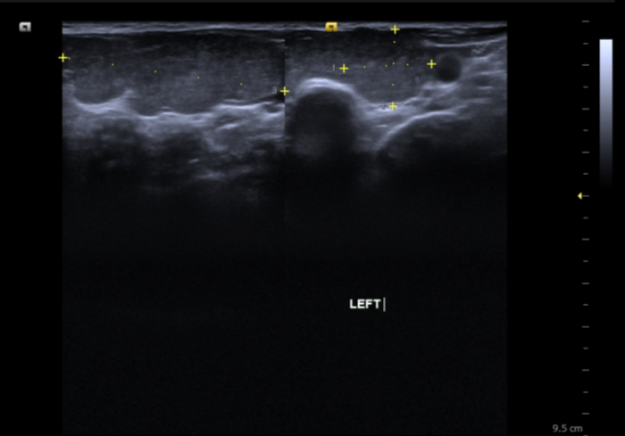 Image Radiopaedia Org