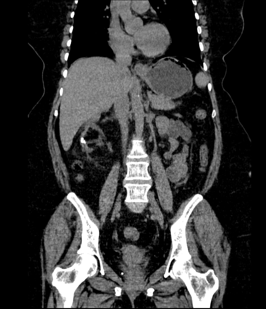 Images Radiopaedia Org