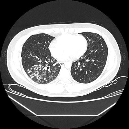 Radiology Quiz 31683 Radiopaedia Org