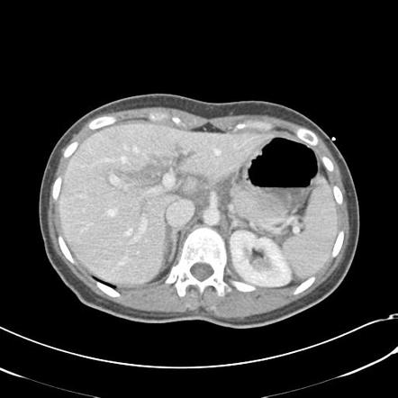 Radiology Quiz 33572 Radiopaedia Org Playlist Core Conditions 01 1