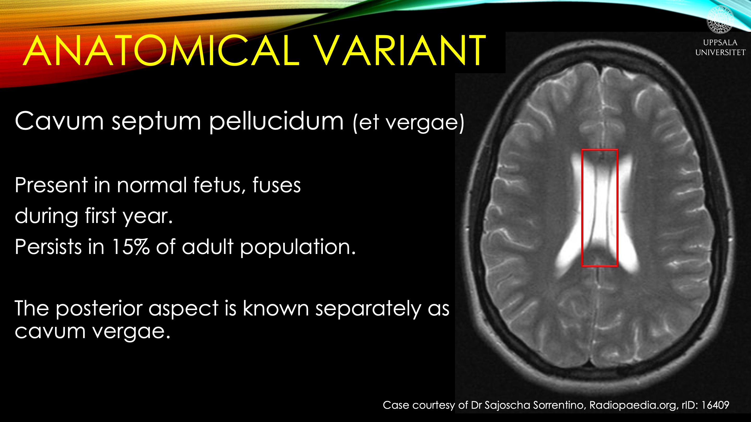 Radiology Quiz Radiopaedia Orgviewing Playlist Glnr