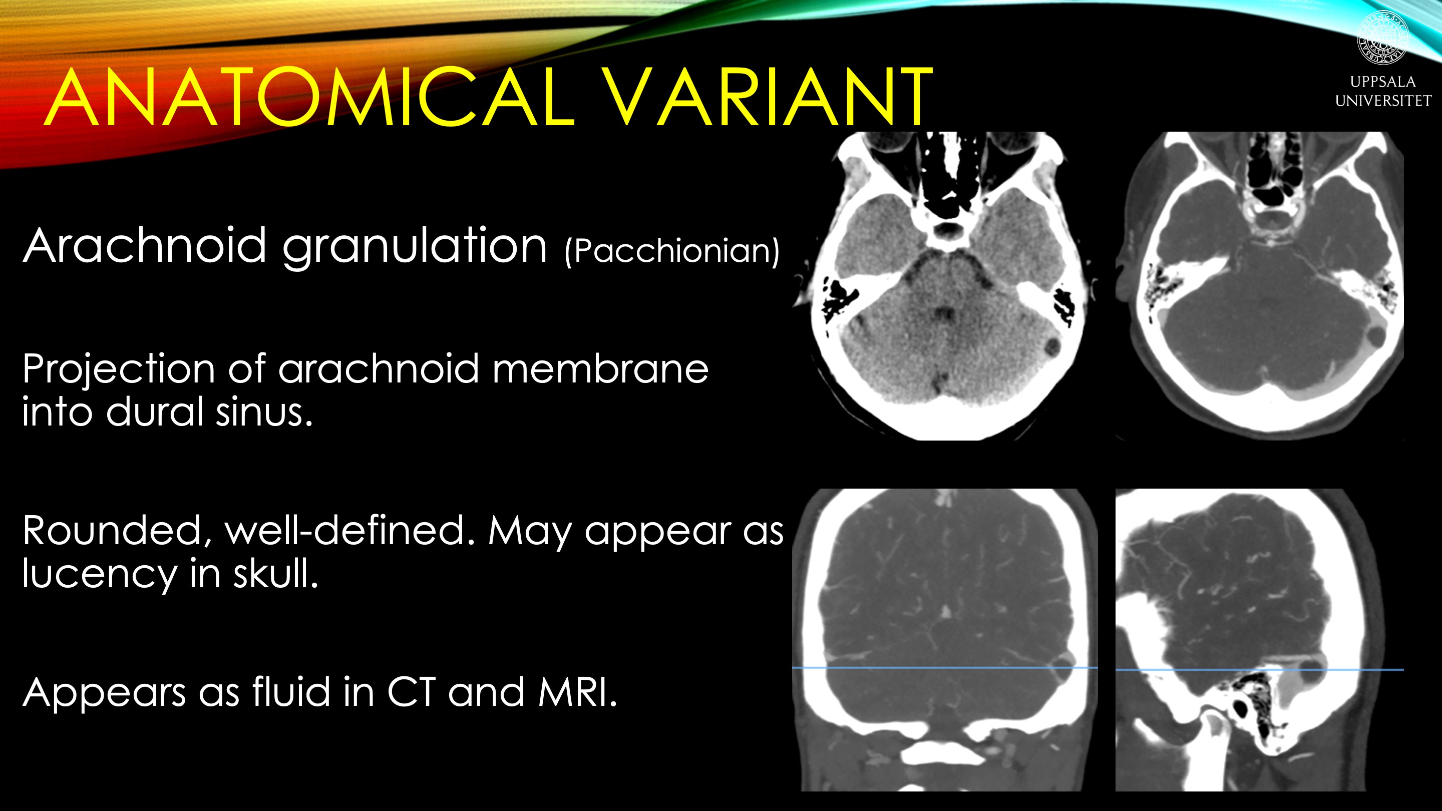 Radiology Quiz Radiopaedia Org Playlist Intracranial